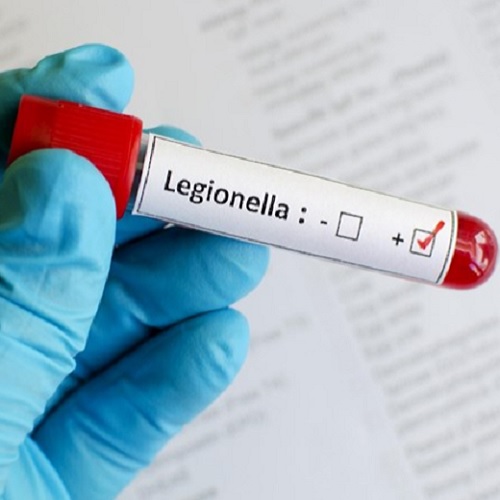 Legionella preventie en onderzoek